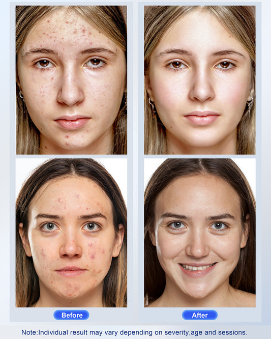 Red Light therapy Mask for Face Wrinkles,Silicone Portable Led Facial Mask Light Therapy for Full Face Even Skin Tone,Fine Lines&Wrinkles,10- Min Treatment,Wired